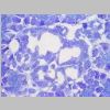 Pancreas SF 23.jpg